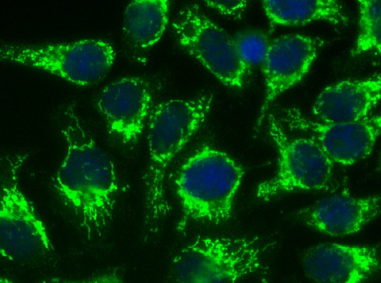 UltraCruz ? Mounting Medium  防熒光淬滅封片劑  sc-24941